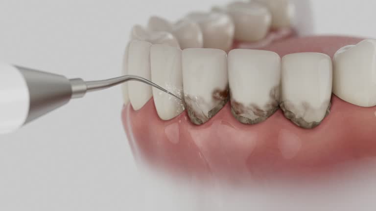 Reliable Dental contractor in Bel-Nor, MO by Smile Center Dentistry